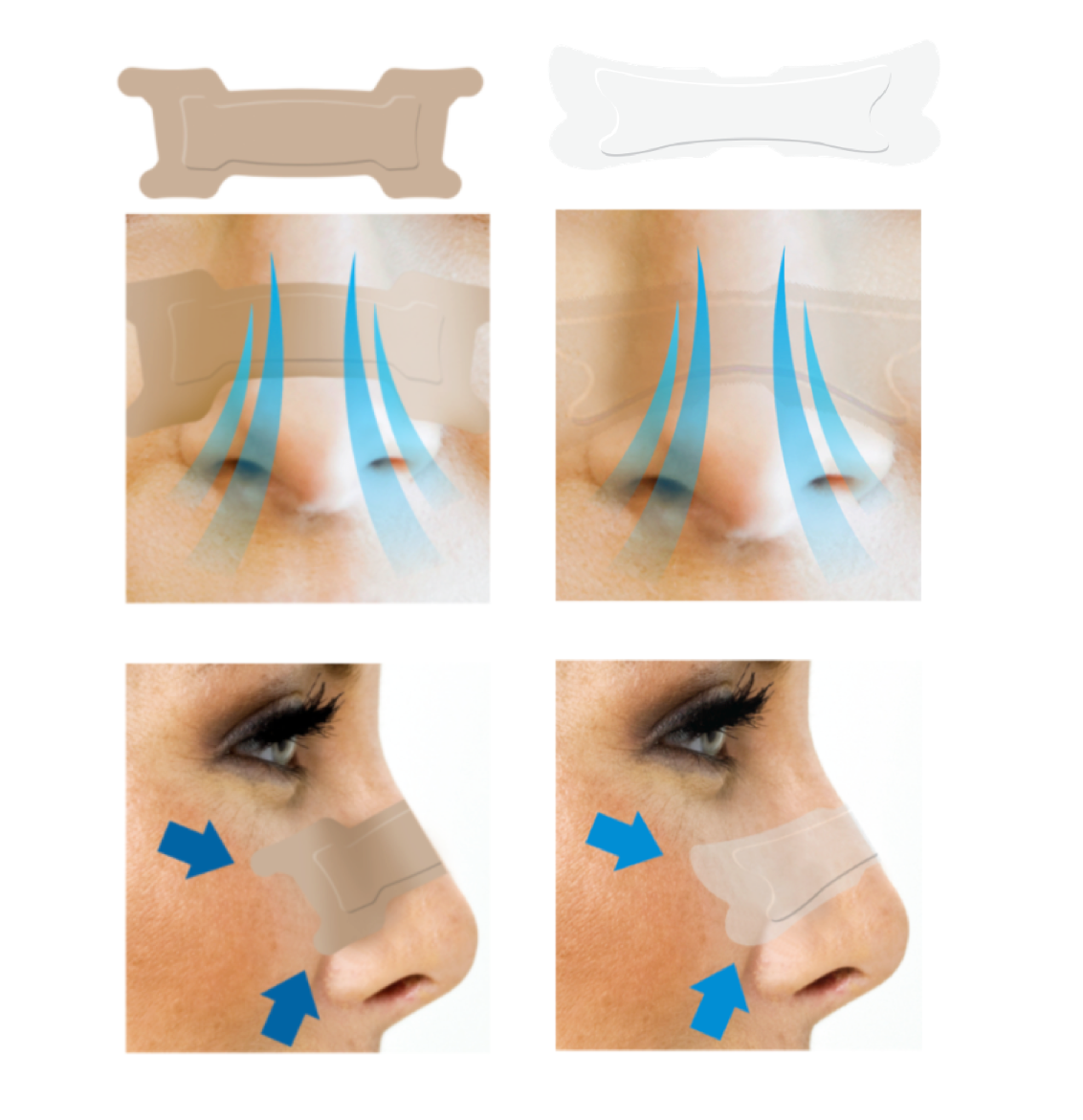 Nasal Strips